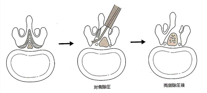 腰部脊柱管狭窄症 脊椎外科 牧整形外科病院 大阪市城東区 脊椎 人工関節 スポーツ整形 ペインクリニック 牧ヘルスケアグループ 医療法人 清翠会