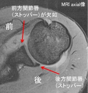 カート 損傷 バン